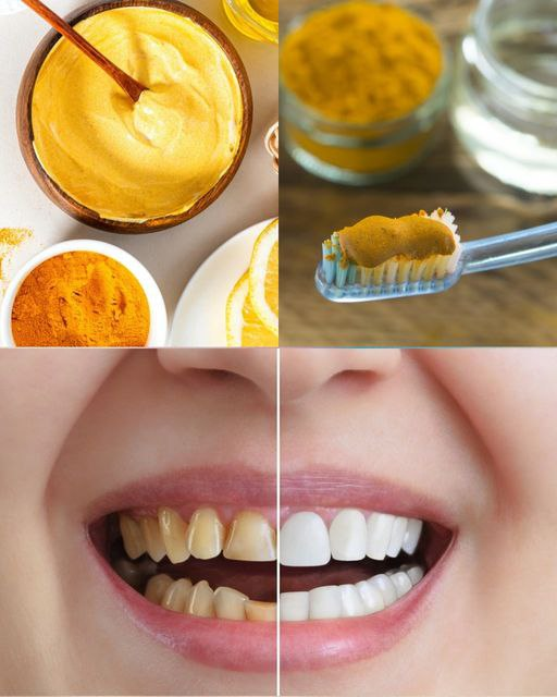 Learn about the natural wonder that turmeric may do for your dental health.